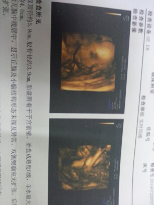 journal_insert_pic_146828504