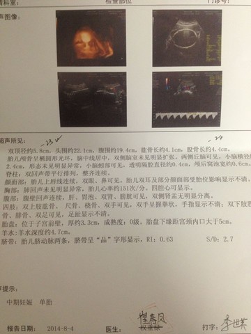 journal_insert_pic_147801445