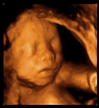 怀孕32周胎儿图片真人图片