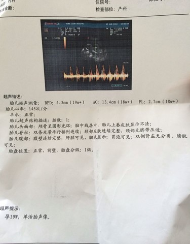 journal_insert_pic_148019060