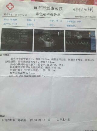 journal_insert_pic_149631439