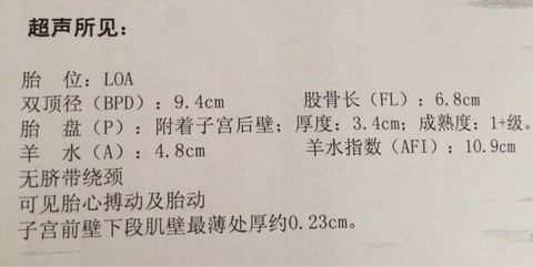 journal_insert_pic_149809552