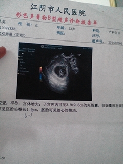journal_insert_pic_149856994
