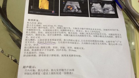 journal_insert_pic_149856846