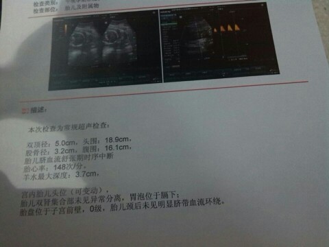 journal_insert_pic_150083907