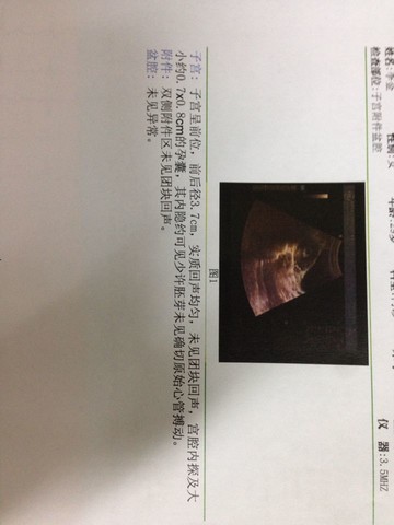 journal_insert_pic_150520359