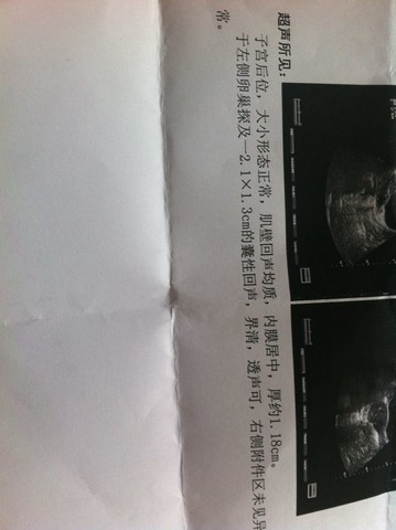 journal_insert_pic_150847287