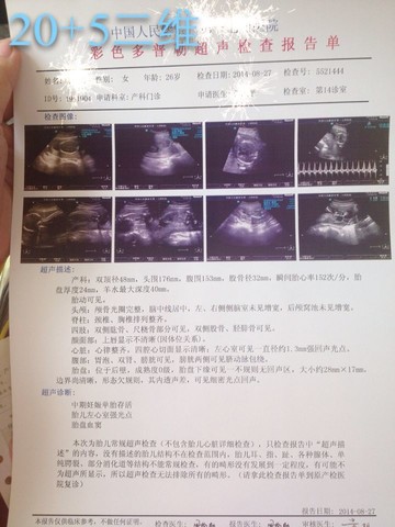 journal_insert_pic_151686697