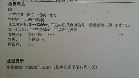 journal_insert_pic_151658926