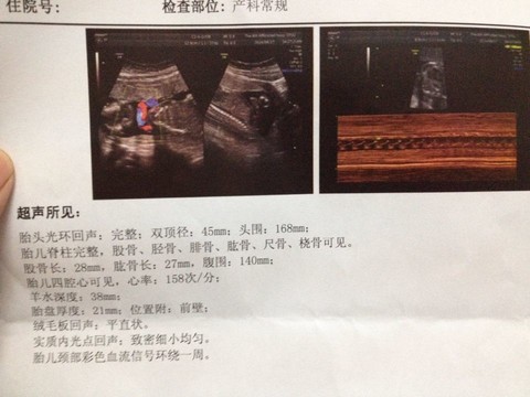 journal_insert_pic_151762001