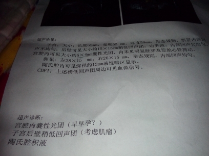 journal_insert_pic_152138064