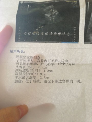 journal_insert_pic_152493476