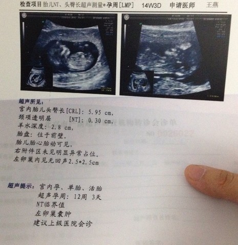 journal_insert_pic_153472454