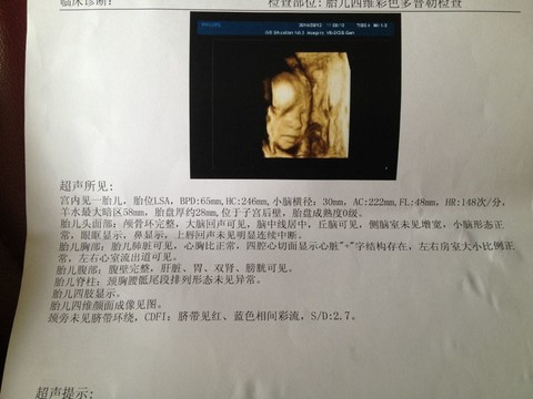 journal_insert_pic_154109903