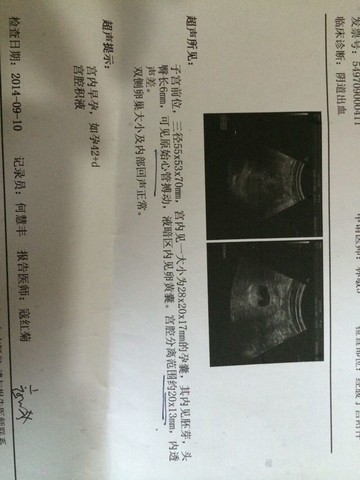 journal_insert_pic_154202184