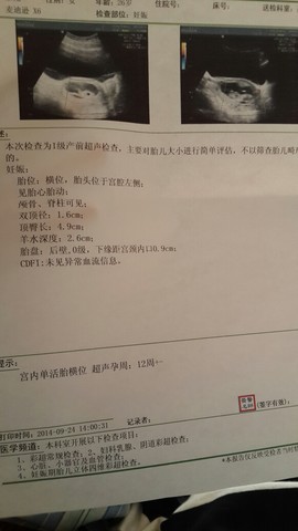 journal_insert_pic_155787892