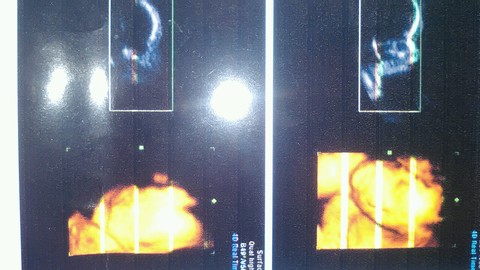 journal_insert_pic_156171595