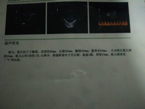 journal_insert_pic_156150560