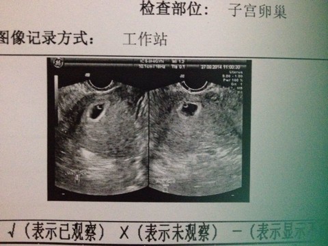 journal_insert_pic_156425180
