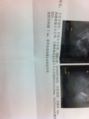 journal_insert_pic_157454899