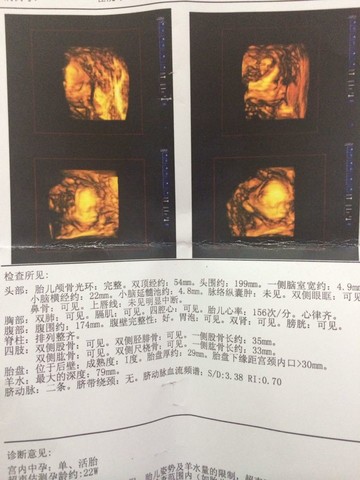 journal_insert_pic_158702108