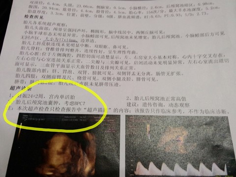 journal_insert_pic_159515856