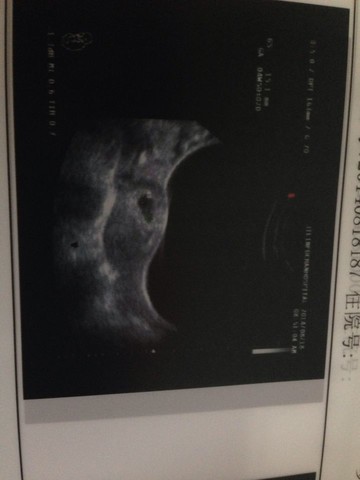 journal_insert_pic_160107156