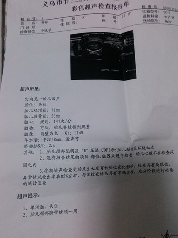 journal_insert_pic_160669160