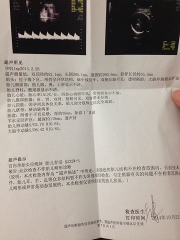 journal_insert_pic_161011135