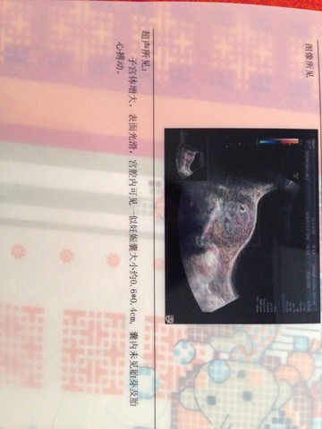 journal_insert_pic_165113326