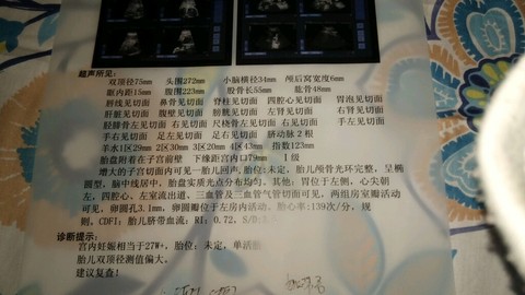 journal_insert_pic_168070386