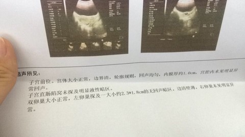 journal_insert_pic_168352224