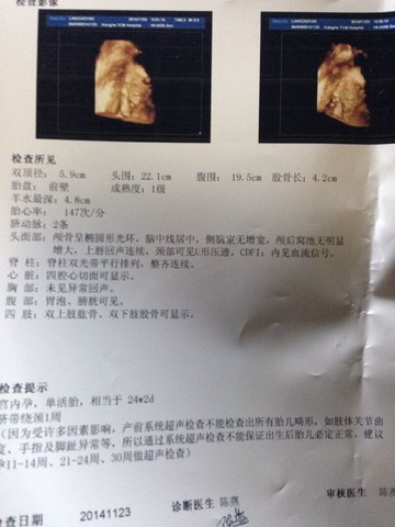 journal_insert_pic_169490983