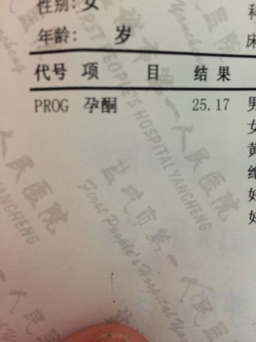 journal_insert_pic_170109502