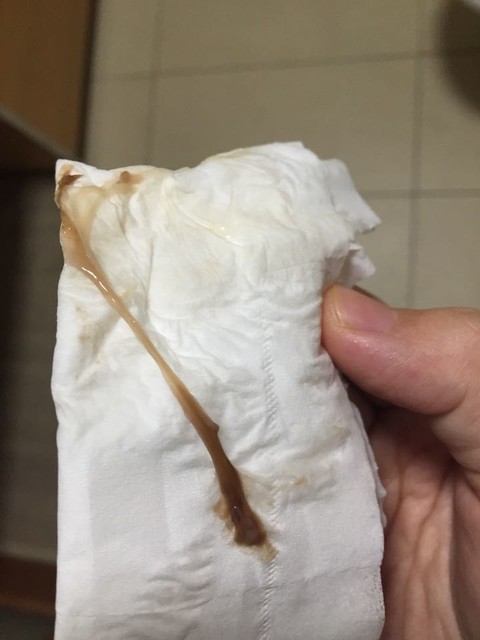 请教各位宝妈,孕37周出现少量褐色分泌物,无腹痛,是见红还是宫颈黏液