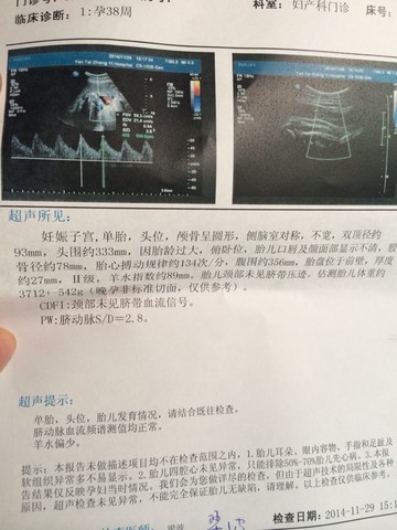 journal_insert_pic_170878010