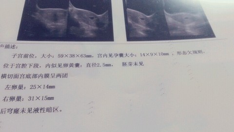journal_insert_pic_171159902