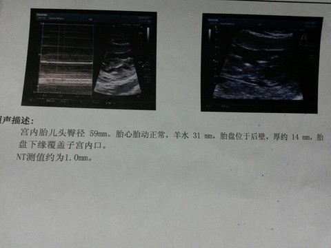 journal_insert_pic_172905547