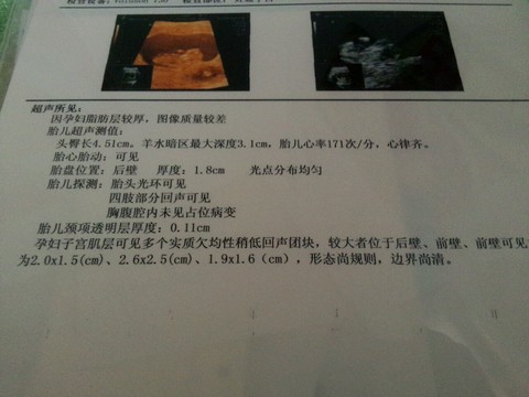 journal_insert_pic_172844195