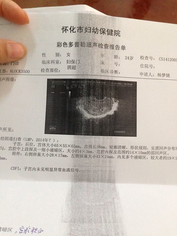 journal_insert_pic_176361605