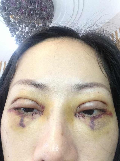 我算整容失败吗