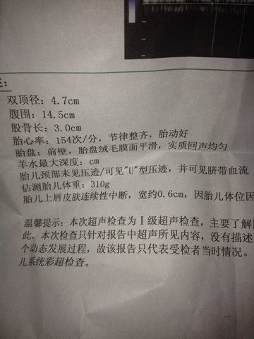 journal_insert_pic_180295127
