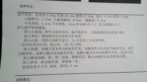 journal_insert_pic_180471340