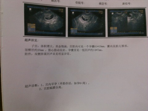 journal_insert_pic_181603501