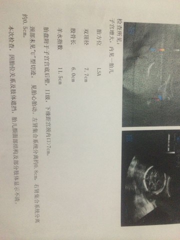 journal_insert_pic_184097640