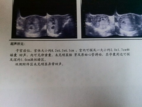 journal_insert_pic_187456121