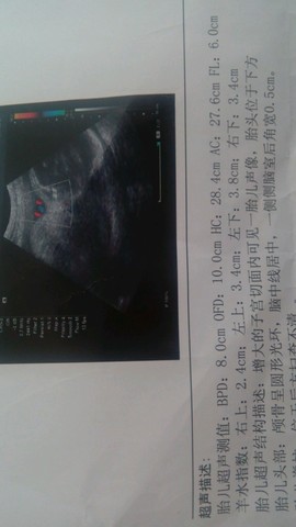 journal_insert_pic_189272104