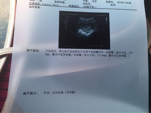 journal_insert_pic_191250359