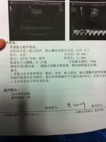 journal_insert_pic_198936715