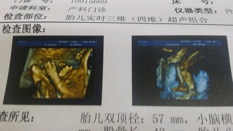 journal_insert_pic_202010003